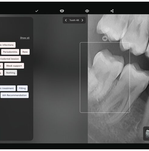 AI:Dental
